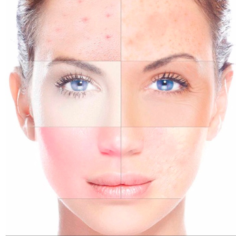 Ángela Morente es un nuevo y acogedor Centro de Estética y Belleza Integral ubicado en el interior del centro deportivo Inacua, de la ciudad de Murcia.